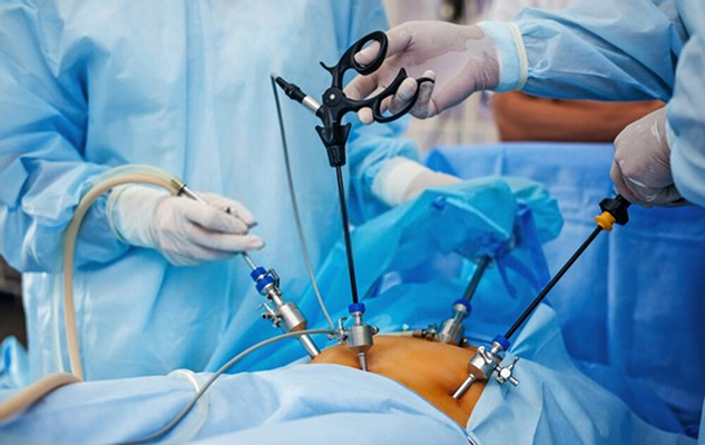 Laparoscopic surgery